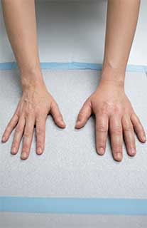 Hereditary Angioedema