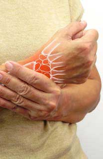 Rheumatoid Arthritis